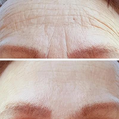Naked And Thriving Renew Serum Before and After Customer Reviews