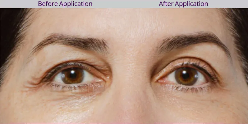 Sbla Eye Lift Wand Before and After