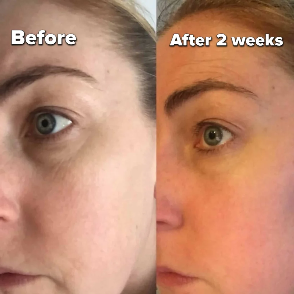 nourishmax eye cream review before and after